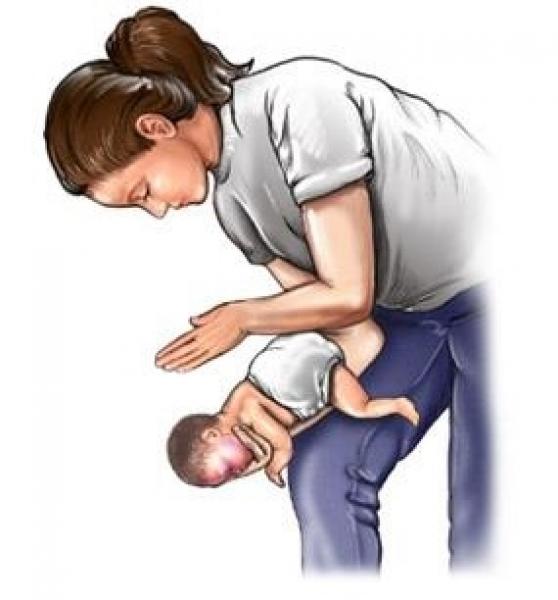 manovra Heimlich 2